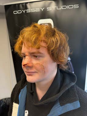 Three-quarter view of the applied character prosthetic after colouring.